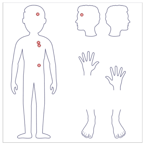 Designated Safeguard Lead Body Map