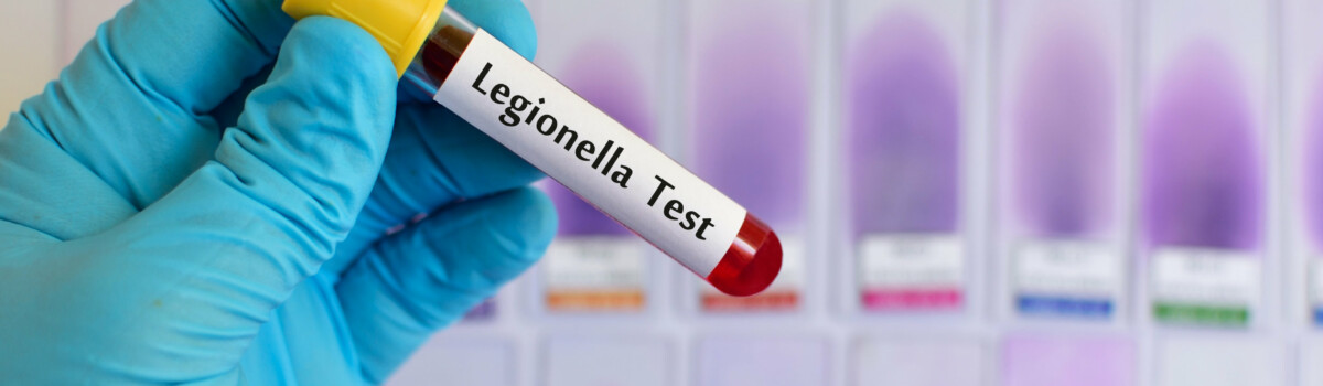 Risk assessment for legionella