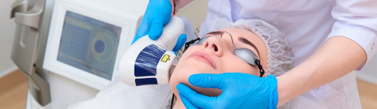 Laser treatment to remove acne scarring