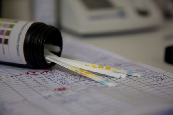 Workplace drug testing | Types, procedures, laws & rights
