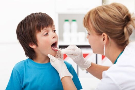 Streptococcus A | Symptoms, prevention, diagnosis & treatment