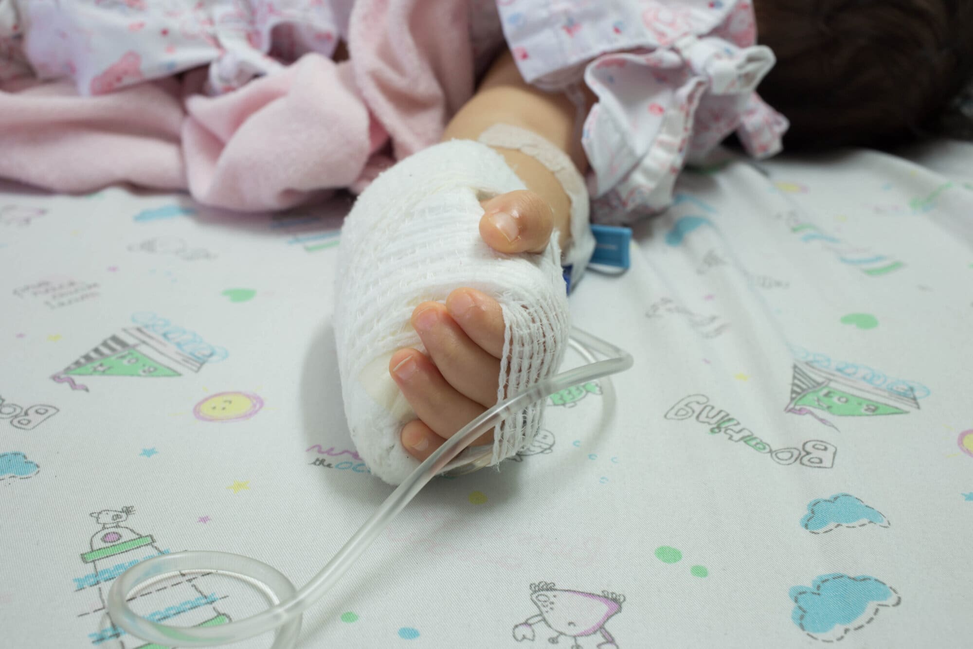 All About Chemical Burns 2 How to Treat a Chemical Burn