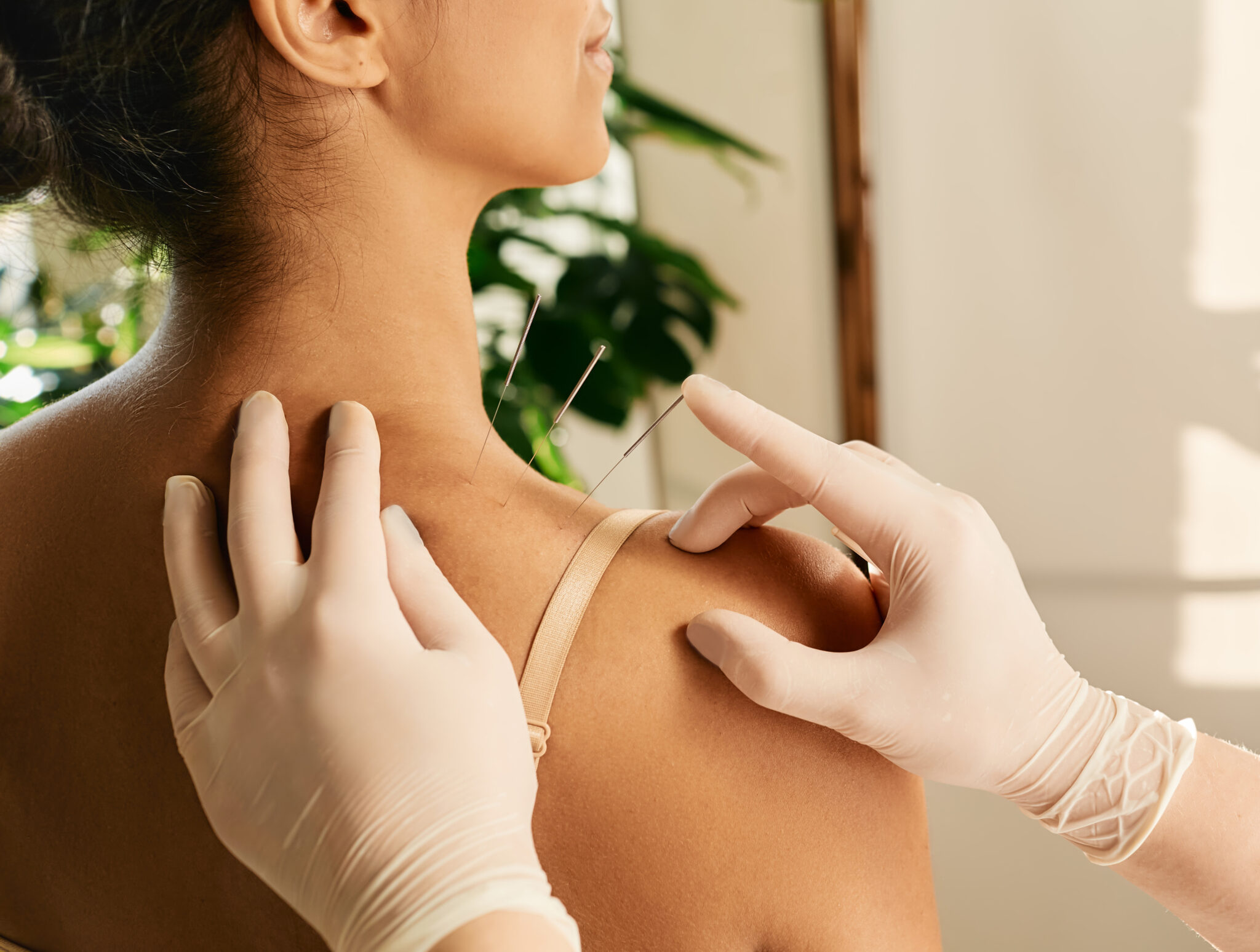 Safe Disposal of Needles and Sharps 3 Sharps Disposal for Acupuncture