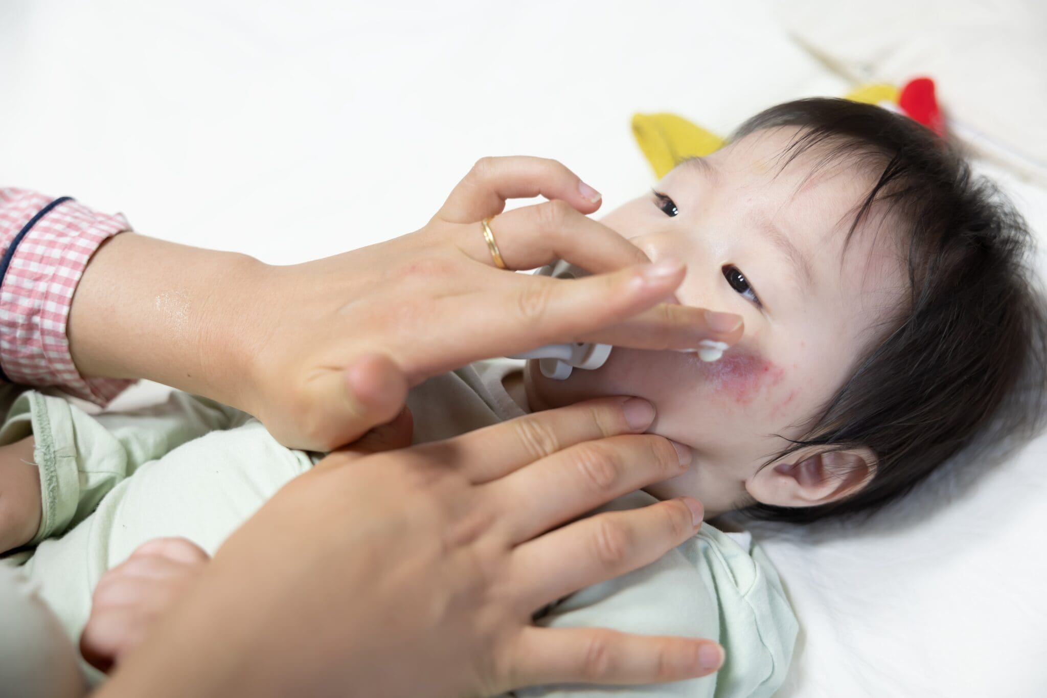 Nutritional Requirements for Babies 4 Babies With Other Allergies